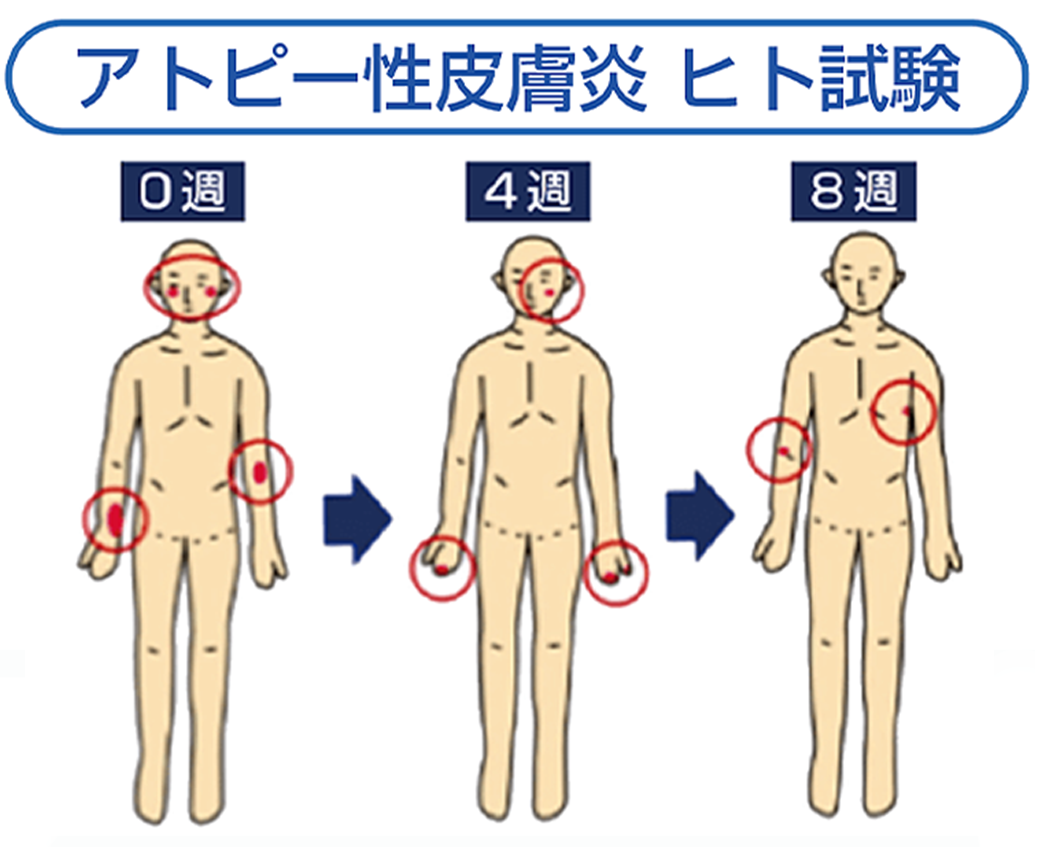 アトピー性皮膚炎 ヒト試験　被験者による評価
